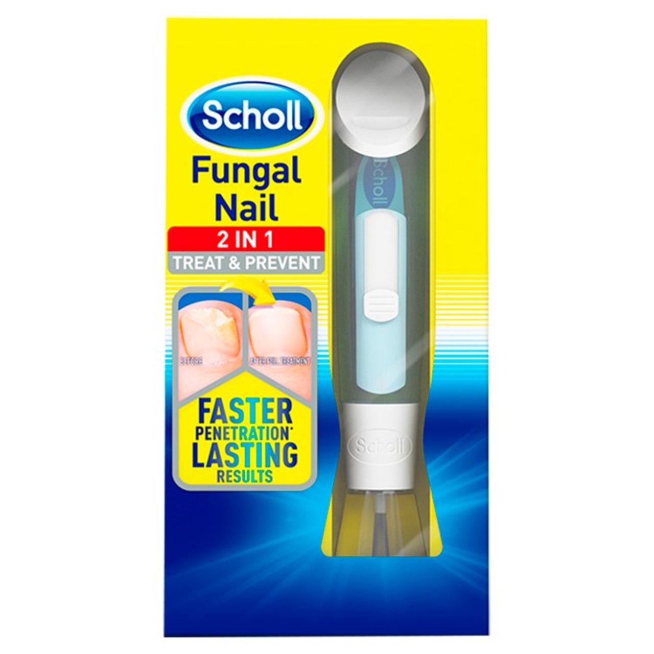 Scholl Fungal Nail Treatment Kit 